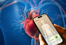 Aeon's AI-Powered Health Screening Gets €8.2M Boost
